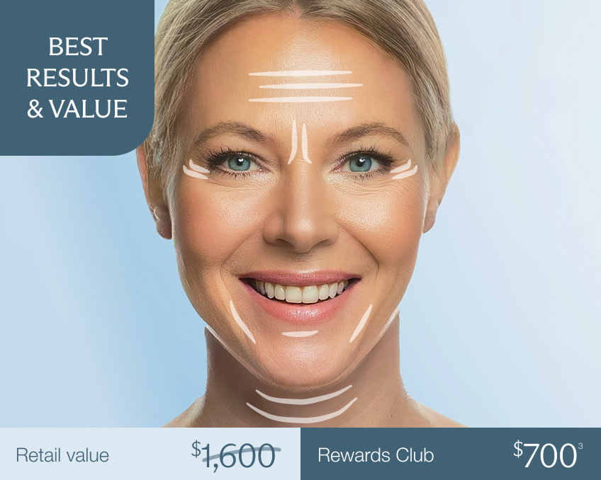 Smiling woman with treatment zones marked on forehead, eyes, cheeks, and jaw—promoting Chapter’s flat-rate pricing tier for full-face Botox and Xeomin treatments. Best results &amp; value.