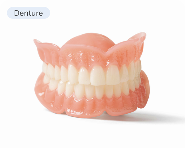  A set of Aspen Dental Signature dentures offering a reliable and comfortable tooth replacement option. The image highlights personalized denture solutions.