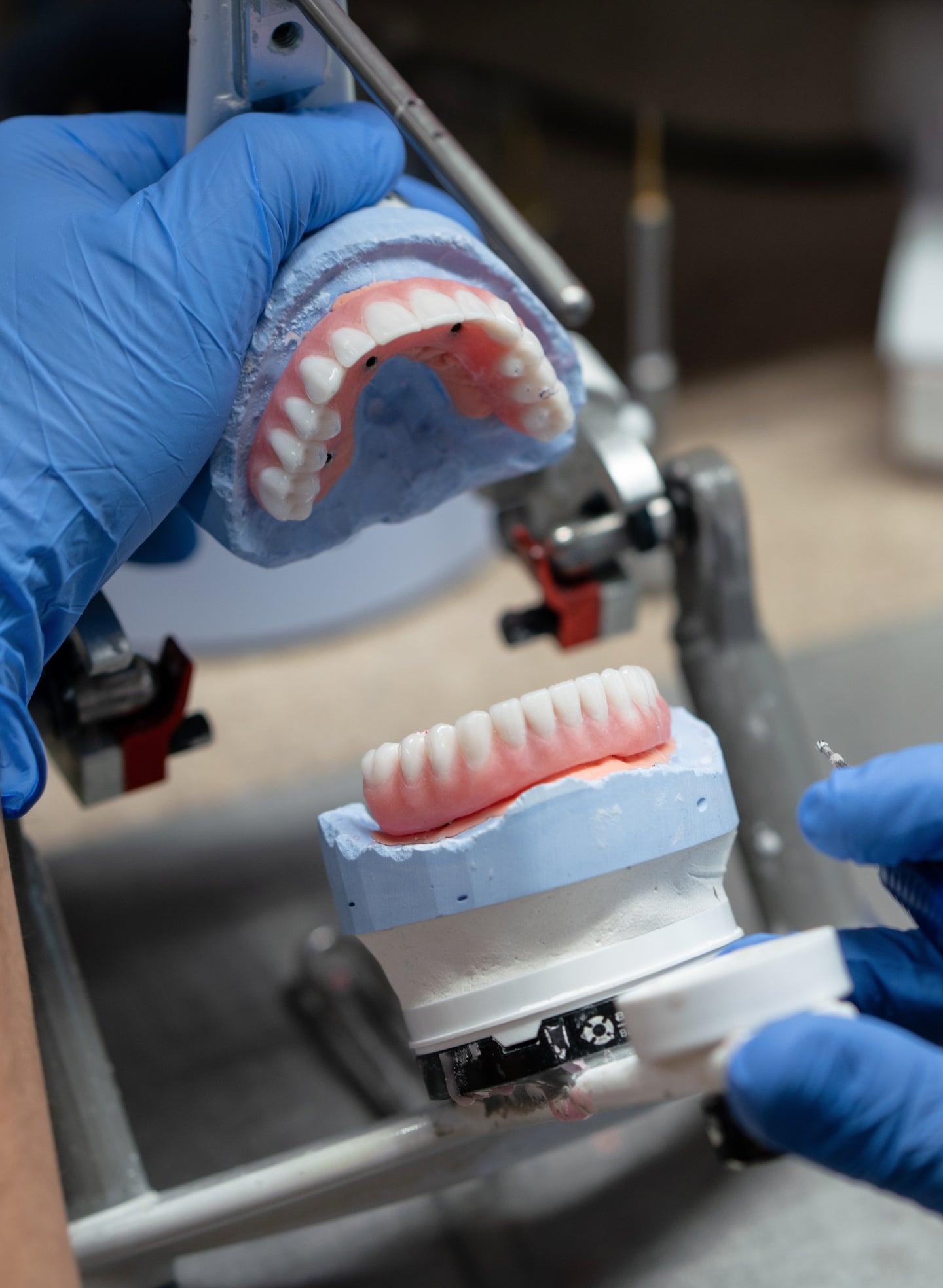 A ClearChoice dental technician wearing blue gloves holds two dental models, showcasing implant-supported dentures in a lab setting. The image highlights the precision of dental implant fabrication, relevant to understanding the key differences between root canals and dental implants.