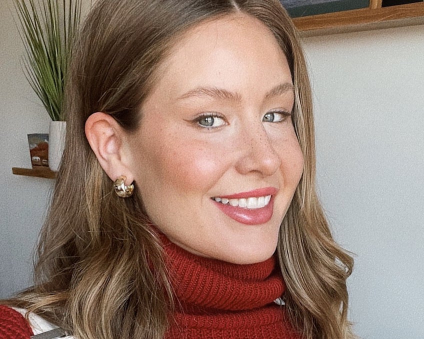 Smiling woman showing off her straightened teeth, highlighting results from Motto Clear Aligners.4o