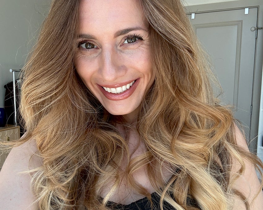 Smiling woman showing off her straightened teeth, highlighting results from Motto Clear Aligners.4o