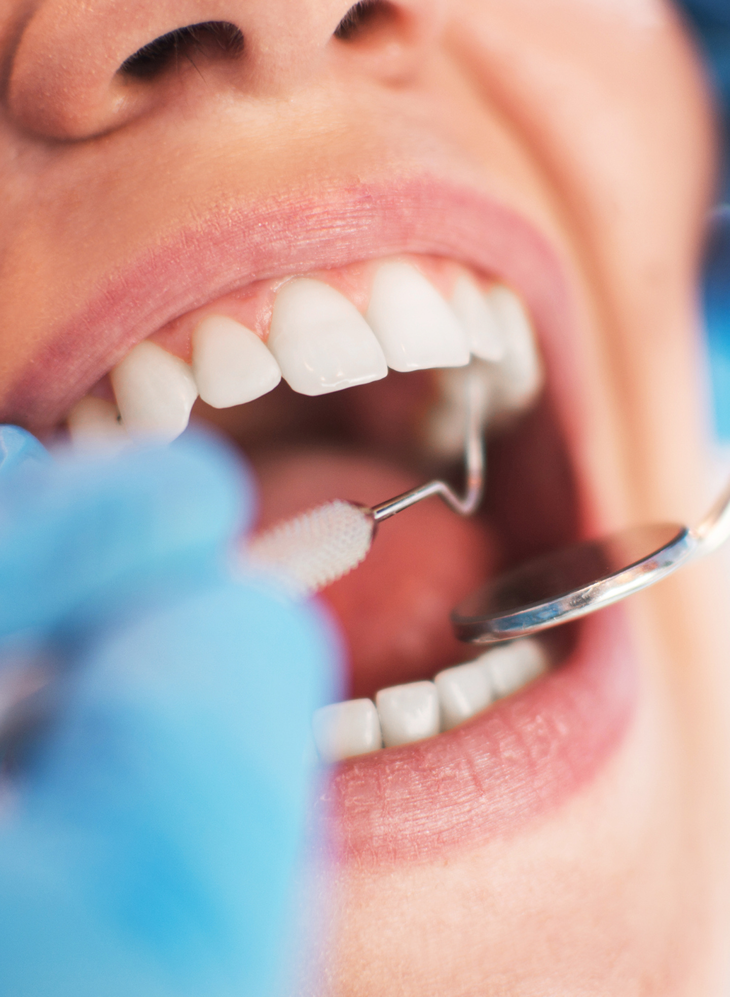 A close-up of a dental professional examining a patient's open mouth with a dental mirror and tool. The image highlights the gum area where a tooth extraction has occurred, emphasizing dry socket symptoms. Aspen Dental provides expert care for the prevention and treatment of dry socket to ensure proper healing.