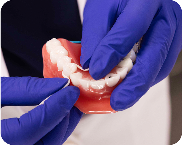 Flossing around an implant crown using a dental model – Aspen Dental hygiene demonstration.