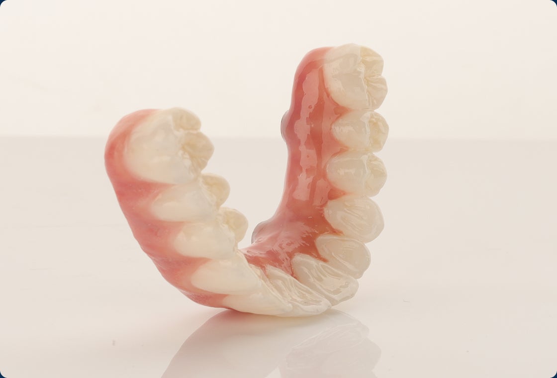 A zirconia dental arch with titanium implants and natural-looking gum and teeth.
