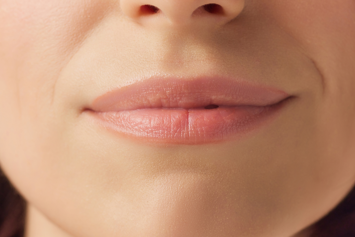 A closeup of lips after receiving filler treatment at Chapter Aesthetic Studio