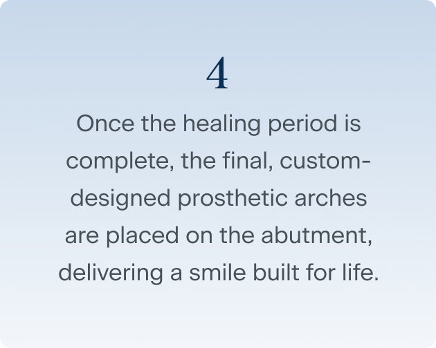The fourth and last step of the dental implant surgery procedure, where the custom-designed prosthetic arches are placed on the abutment after the healing period is complete, delivering a smile built for life.