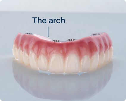 An image of the arch, the visible part of the dental implant, made with top-quality material like zirconium for long-lasting implants.