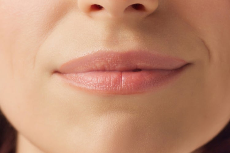 Closeup of a woman’s lower face after a dermal filler treatment at Chapter Aesthetic Studio.