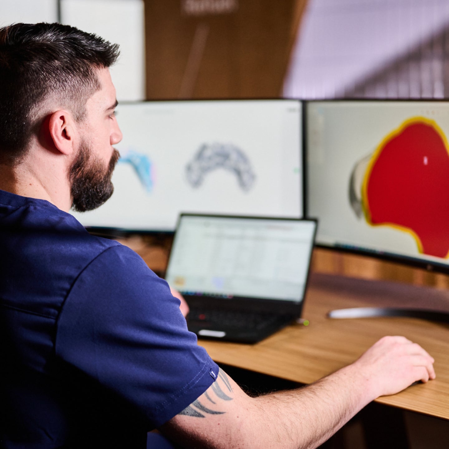 An Aspen Dental doctor looks at a computer displaying implant schematics. 