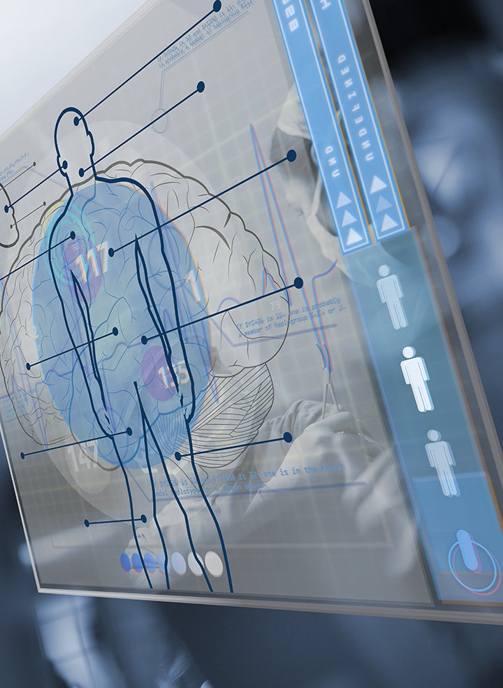A digital illustration of a medical chart, featuring an outline of the human body overlaid on top of a brain.