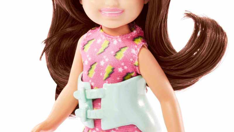 Mattel released a new Barbie doll with scoliosis