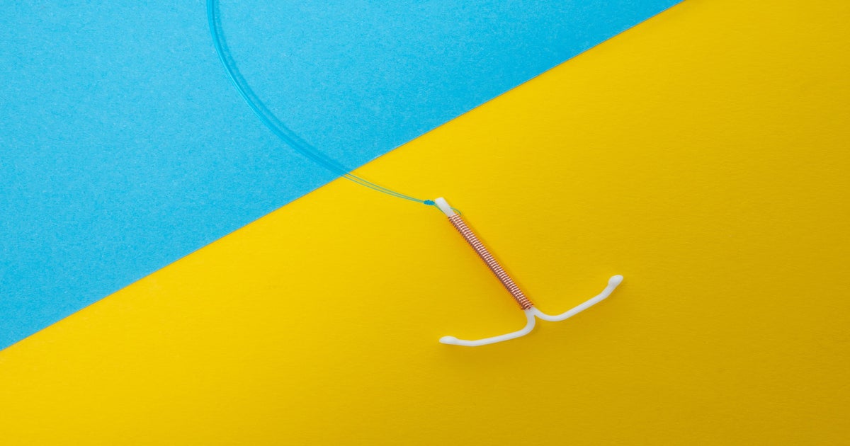 How Abortion Laws Affect Access to Birth Control