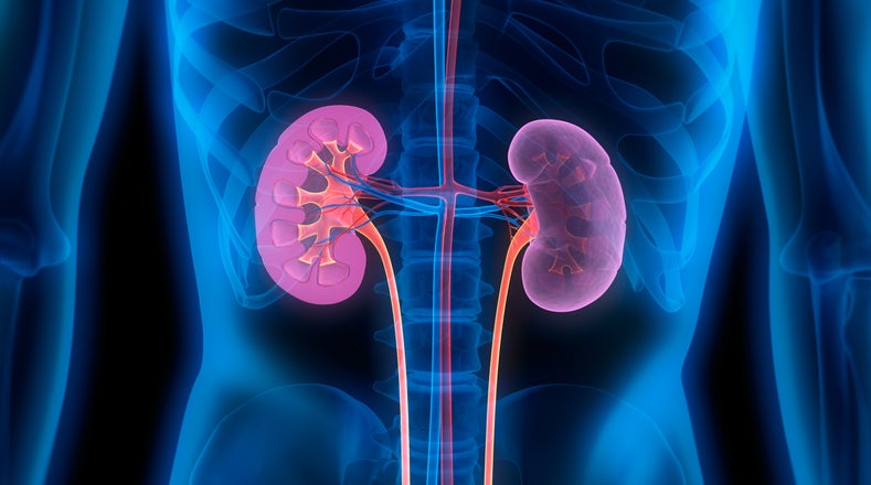 Kidney Cancer
