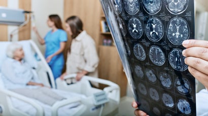 Stroke Services