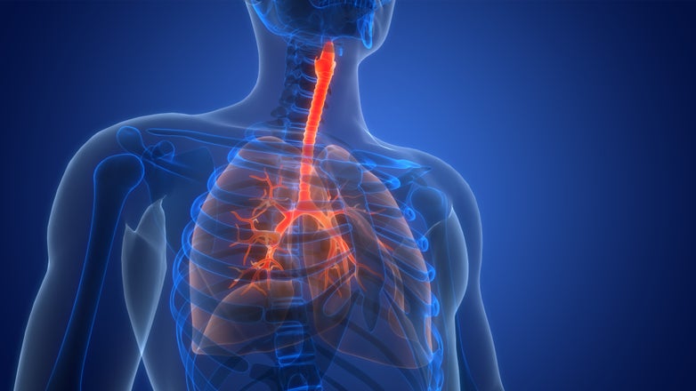 Lung Cancer