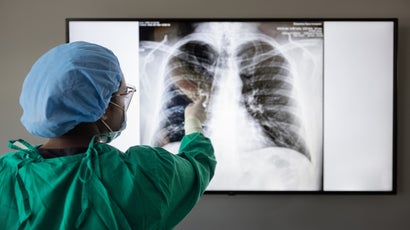 Pulmonary Services