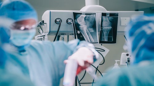 Arthrogram