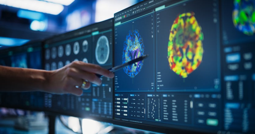 Brain & CNS Cancer