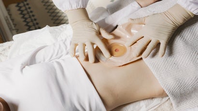 Wound Ostomy Nurse Consultant