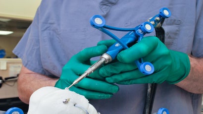 Navio Robotic Assisted Orthopedic Surgery