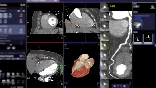 Heart PET/CT Imaging